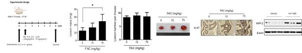 Effect of iron on iron-induced migration in human endometriotic cells