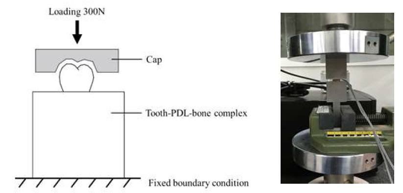 Experimental setup on tooth-PDL-bone complex using universal testing machine