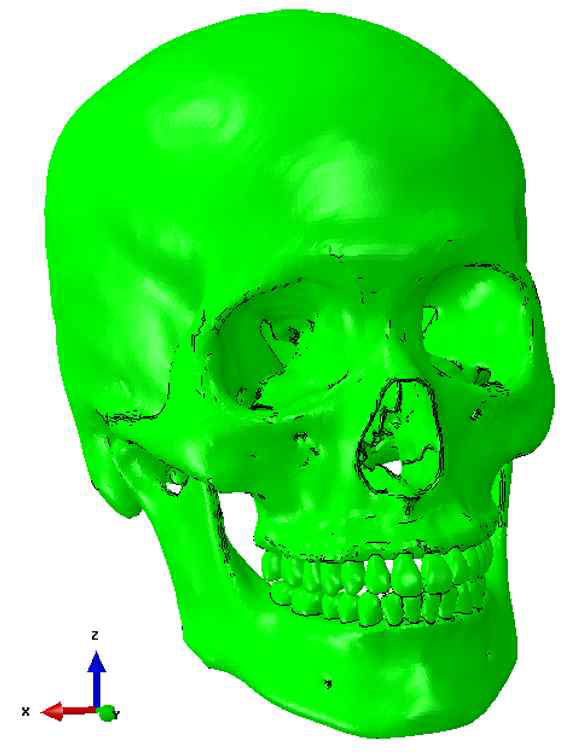3-dimensional model of skull with occlusion for class I