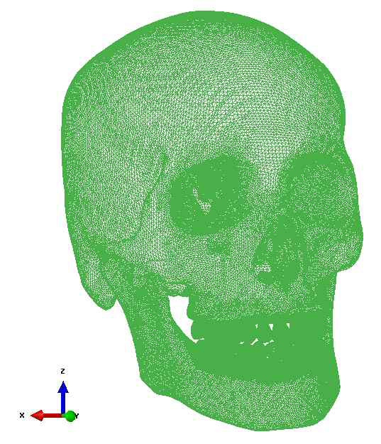 FE skull model with occlusion for class I
