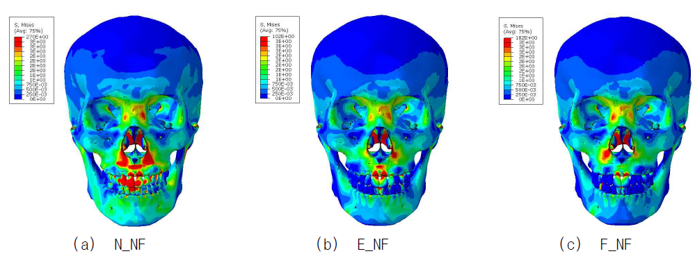 Stress distributions of the skull models without food