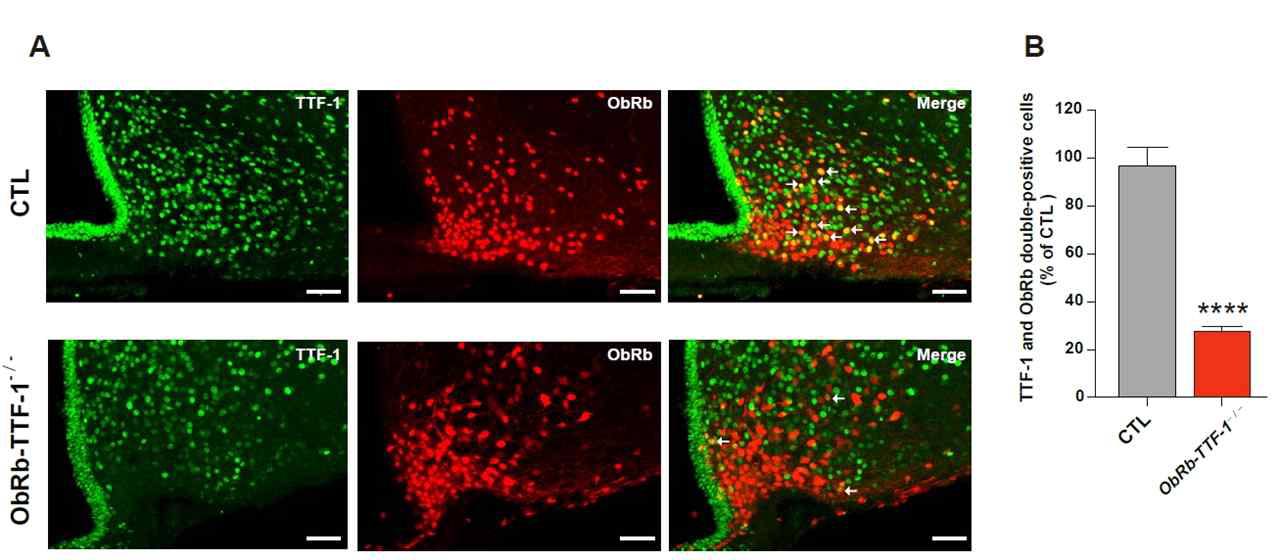 ObRb-TTF-1-/- 생쥐 모델 검증