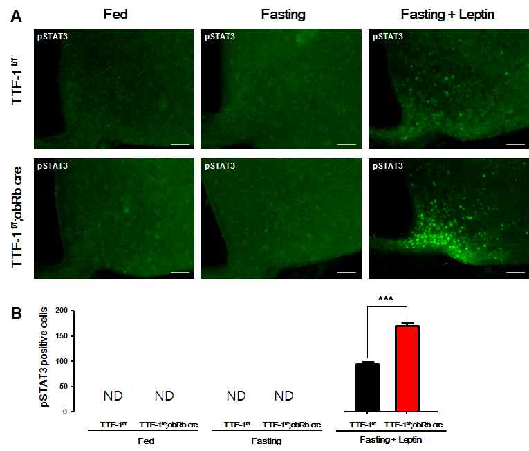 ObRb-TTF-1-/- 생쥐에서 렙틴 신호전달변화 분석