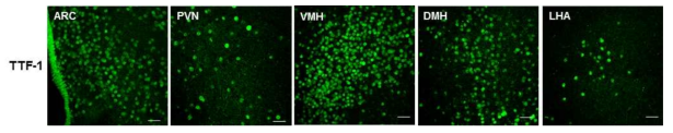 시상하부내 TTF-1 발현 분석