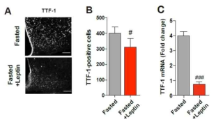 렙틴 주입에 따른 시상하부 내 TTF-1 발현 확인
