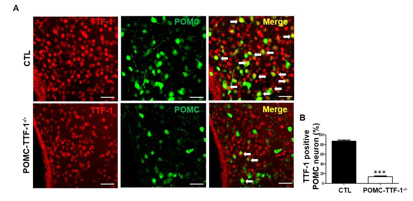 POMC-TTF-1-/- mice 모델 검증