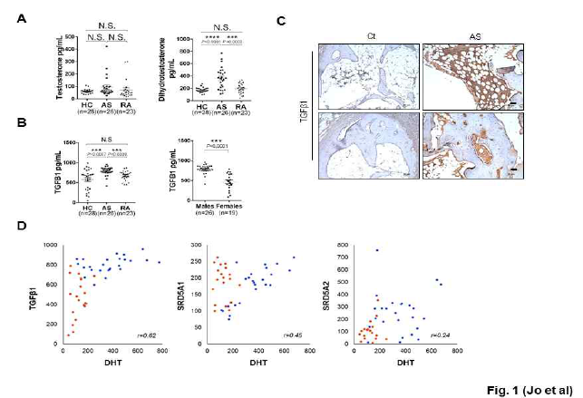 강직척추염 환자에 높은 수준의 DHT와 TGFβ1 발현을 확인함