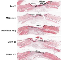 흰쥐 등에 6mm 펀치 후 갈색거저리 유충오일 도포시 농도의존적으로 상처회복이 빠른 결과, Hematoxylin Eosin Stain