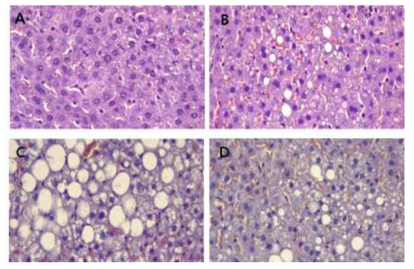 대사질환 흰쥐모델에서 간 조직 현미경사진. (A) Normal 군, (C) Negative 대조군, (B) CT 투여군, (D) PRE 투여군