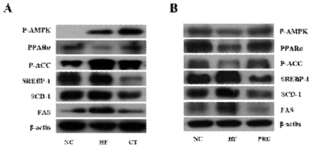 대사질환 흰쥐모델의 간 조직에서의 CT 와 PRE가 대사관련 단백질 발현에 미치는 효과 (A) CT, (B) PRE