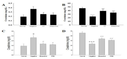 혈청과 뇨 내 creatinine 농도