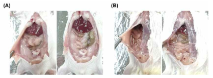 Compound A의 투여 경로 선정을 위한 실험동물의 복강 투여 예비 실험 결과 (A) 실험동물의 무처리 대조군의 내부 사진, (B) 실험동물에 DMSO를 복강 투여시 내부 사진