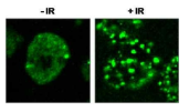 IR-induced 53BP1 foci formation