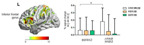 인지 과제에서 상황에 따른 뇌활성화의 집단 간 차이를 보이는 영역