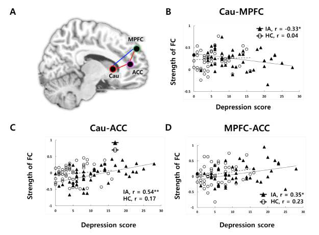 우울 요인에 따른 휴지기 뇌기능 연결성의 변화