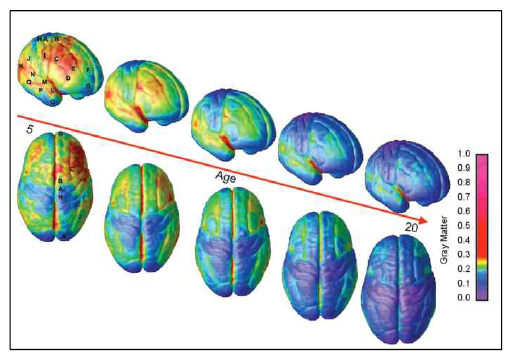 청소년기 뇌의 회백질 발달 양상