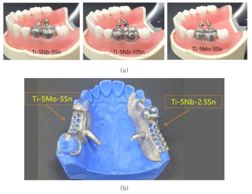 (a) 2-unit bridge crown prothesis fabricated using Ti-5Nb-5Sn, Ti-5Nb-10Sn,Ti-5Mo-5Sn alloys. (b) Partial denture framework fabricated using Ti-5Mo-5Sn and Ti-5Nb-2.5Sn