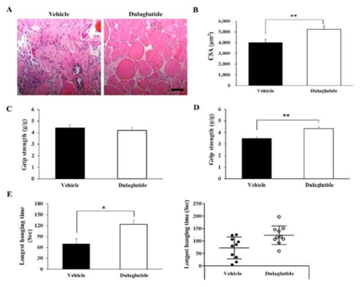 Long acting GLP-1 agonist “Dulaglutide” 는 Mdx 마우스의 근감소증을 개선시킴