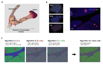 췌장 조직의 해부학적 구분도(A)와 췌장 단면의 이미지(B) 및 알고리즘 분석의 흐름 예시(C)