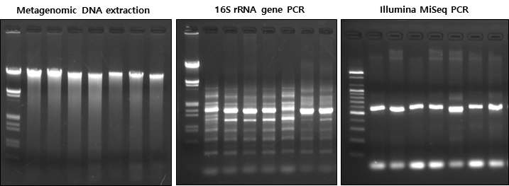 기도 마이크로바이옴 분석을 위한 Metagenomic DNA 추출, 16S rRNA PCR, Illmina Adaptor PCR 결과