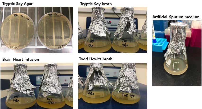 Rothia mucilaginosa (positive control) 균주를 이용한 aerobic condition에서의 배양 배지, 배양 조건에 따른 배양 결과