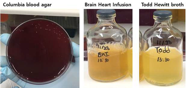 Bacteroides fragilis (positive control) 균주를 이용한 aerobic condition에서의 배양 배지, 배양 조건에 따른 배양 결과