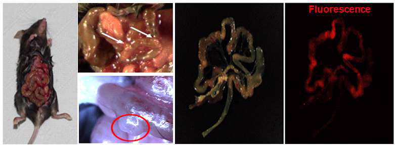 CT26 colon cancer model. Colorectal cancer model was developed in mouse model. We injected CT 26 cells by intraperitoneal into the mouse. NPs were injected iv and images after 24 hrs treatment. Cancer imaged under bioimaging instrument with NIR light. Images showing that colorectal cancer was developed and yellow arrow mark expressed the place of tumor development and PASH NPs target to the tumor region