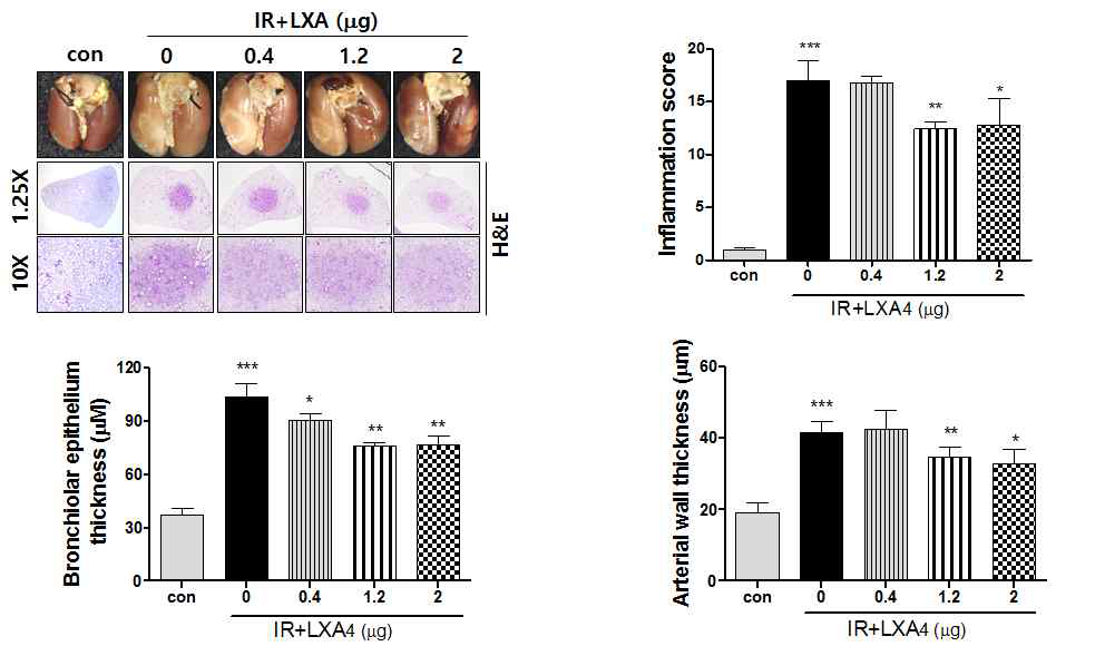 H&E 염색을 통한 Lipoxin A4의 항염증반응 확인