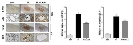 immunohistochemistry를 통하여 cytokine에 대한 LipoxinA4의 효과