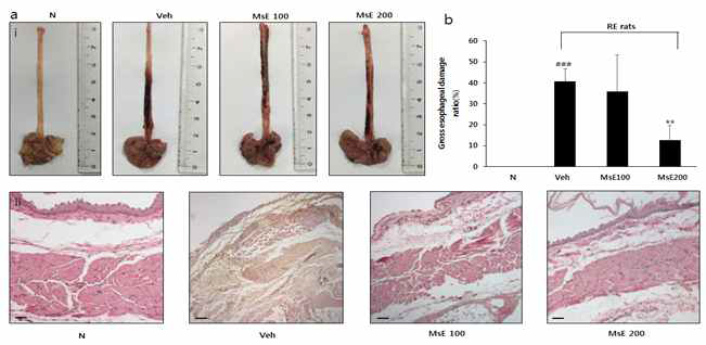 Effects of MsE on esophageal reflux induced esophageal mucosal damage in rats. Gross (a-i), microscopic (scale bar 200 μm) (a-ii), and the gross ratio of esophageal mucosal damage (b). ###p<0.001, vs. Normal rats; **p<0.01, vs. RE controlled rats. Data are expressed as mean ± standard deviation