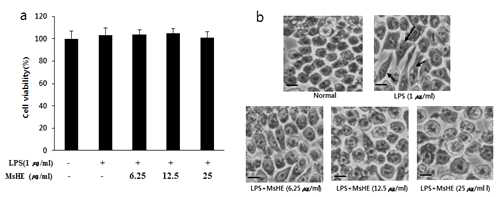 Effects of MsHE on viability (a) and morphology (b) in RAW 264.7 cells was measured by cell viability, proliferation ＆ cytotoxicity assay kit, morphology of cells was captured by optical microscopy. Data are expressed as mean ± standard deviation. All experiments were performed in three independent experiments. Scale bar was 200 μm