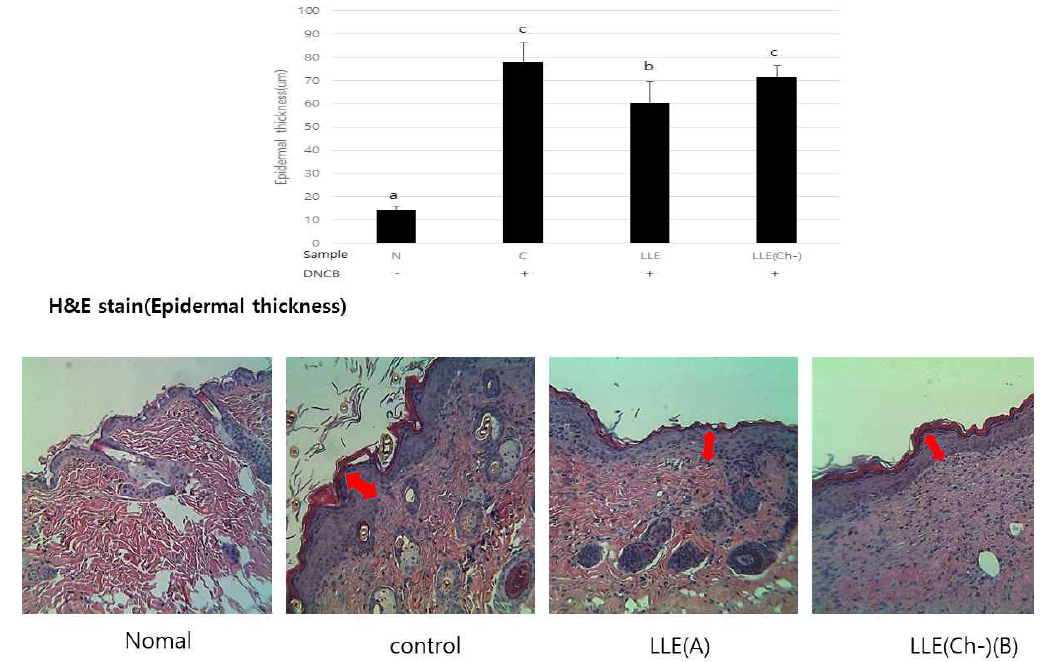 Lycium bararum leaf extracts(LLE), leaf extracts without chlorophyll(LLE(CR-)) on Epidermal thickness of NC/Nga mice (A) Different superscript within the same column indicate significant differences(P<0.05) among group by scheffe’s multiple range test after ANOVA (B) The histopathologic features(x40) of the epidermis in NC/Nga mice