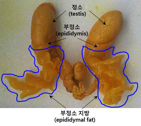 남성 생식 기관과 부정소 지방