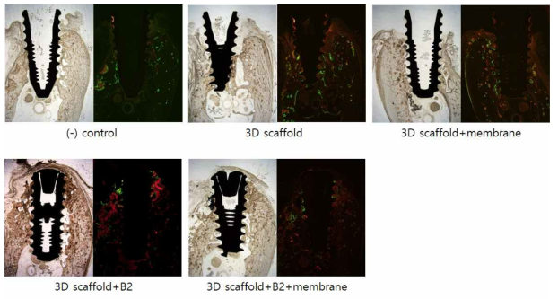 재생술식 16주 후 비탈회사진. 각각의 사진에서 좌측은 광학현미경으로 관찰한 모습이며, 우측은 형광현미경으로 관찰한 사진임. 붉은색 선은 4주에 형성된 뼈를, 녹색선은 8주에 형성된 뼈를 나타냄. * 3D scaffold: Collagen+bone block, B2: BMP-2, membrane: collagen membrane