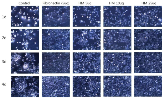 심근세포의 adhesion 및 세포증식 및 에 대한 dHtECM 의 농도별 및 Fibronectin 대조군과 의 비교