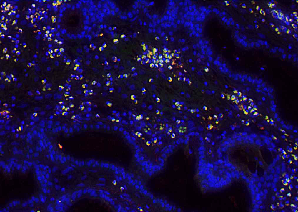 CD68 + Leptin R