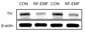 The effect of RF-EMF exposure on TH protein in striatum of aging-PD mice