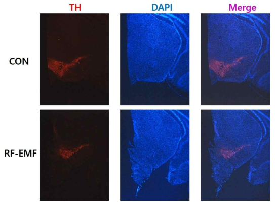 The effect of RF-EMF on TH expression in substantia nigra(SN) of aging-PD mice