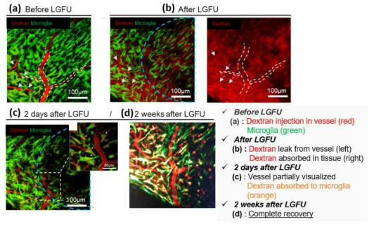 LGFU에 의한 생쥐 뇌의 BBB 개방을 다광자 현미경 영상을 통해 확인한 결과 (적색-모델 약물분자, 녹색-미세아교세포): (a) LGFU 적용 전; (b) LGFU 적용 후 모델약물분자 누출 확인 (좌측그림: 점선 영역이 초음파가 입사된 부분이며, 흰색 화살표는 초음파 표적 외부 혈관을 보여줌; 우측그림: 누출된 모델 약물분자가 주변부로 확산된 모습; (c) LGFU 조사 후 2일 경과된 다음 동일 부위를 다광자 현미경으로 혈관 관찰한 결과. 대부분의 모델 약물분자가 사라짐 (미세아교세포가 모델 약물분자를 흡수하여 주황색으로 나타남). 또한 혈관의 형상이 선명하게 확인됨; (d) 2주 후 완전하게 회복된 혈관이 확인됨