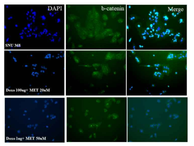 Metformin promotes the plasma membrane translocation of β-catenin. SNU368 cells preincubated for 24 h with metformin and challenged with doxorubicin were fixedand processed for immunofluorescence analysis