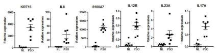 한국인 건선병변 RNA 시퀀싱 결과 validity