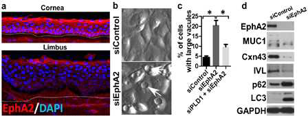 각막세포에서 EphA2의 자가 식작용과 세포분화에 미치는 영향. (a) EphA2의 각막상피세포(cornea)에 특이적인 발현. (b) EphA2 넉다운 유도 세포에서 액포의 형성 (화살표). (c) EphA2와 PLD1의 더블-넉다운(double-knockdown)세포에서 액포형성 감소. (d) EphA2 넉다운 세포에서 세포분화 마커(MUC1과 involucrin, (IVL))의 감소, LC3와 p62의 증가 양상을 나타낸 western blot실험