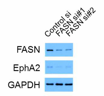 FASN에 의한 EphA2발현 조절. 인체 각막세포주인 hTCEpi세포를 이용하여 FASN에 대한 siRNA를 tranfection을 수행한 후 48시간 후에 단백질을 분리 정량하였음. siRNA의 off-target효과를 감안하여, FASN의 염기서열 부분을 타겟하는 두 개의 서로 다른 siRNA를 이용하였음. 단백질 loading control로는 GAPDH의 발현을 측정하였음