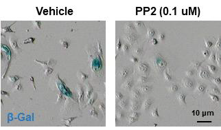 Src kinase억제제의 처리 후 β-galactosidase을 통한 세포노화 관찰. Scr kinase의 억제제인 PP2를 0.1 uM농도에서 48시간 동안 처리한 후 senescence-associated β-galactosidase kit를 이용하여 세포노화 정도를 관찰하였음