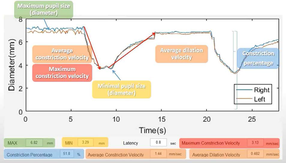 프로그램으로 측정, 계산 할 수 있는 다양한 동공 파라미터들