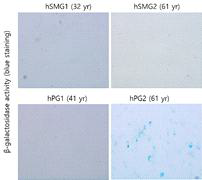 타액선 조직 위치 (SMG vs. PG) 및 나이별 타액선 세포에서의 senescence 비교