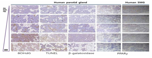 The expression patterns of 8OHdG, TUNEL, beta-galactosidase and PPARr on human salivary gland tissue with age