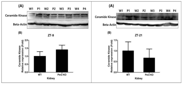 Expression of ceramide kinase protein from the kidney in wild-type and mPer2 knockout mice at ZT-9 and ZT-21