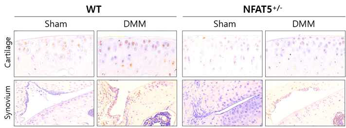 DMM 유도 후 8주에 WT 마우스와 NFAT5+/- 마우스의 무릎 내 연골과 활막조직에서 MMP13에 대한 면역조직화학염색 (unpublished data)