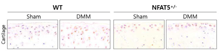 DMM 유도 후 8주에 WT 마우스와 NFAT5+/- 마우스의 무릎 내 연골에서 ADAMTS-5에 대한 면역조직화학염색